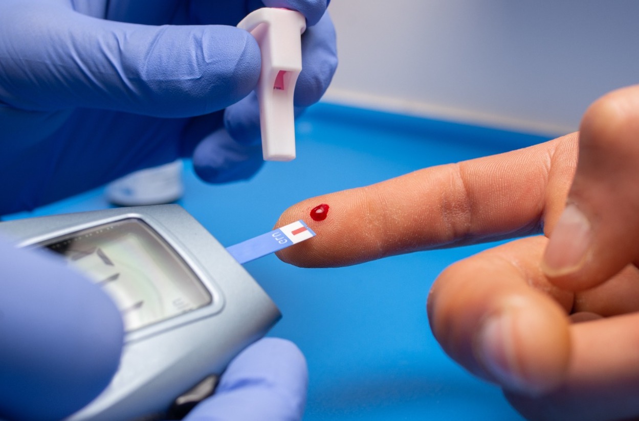 اوزون تراپی: راهی برای درمان زخم پای دیابتی