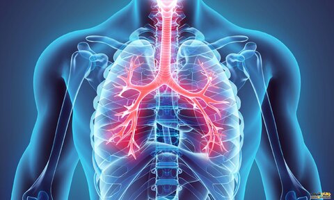 عفونت‌های مرتبط با سیستم تنفسی